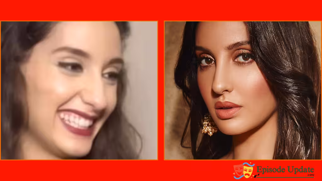 Nora Fatehi Photo Before Plastic Surgery 2 Nora Fatehi Photo Before Plastic Surgery
